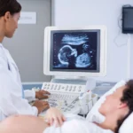 Baby-Brain-during-Pregnancy