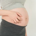 Reason-for-Itchy-Palms-in-Pregnancy