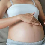 Causes stretch marks during pregnancy